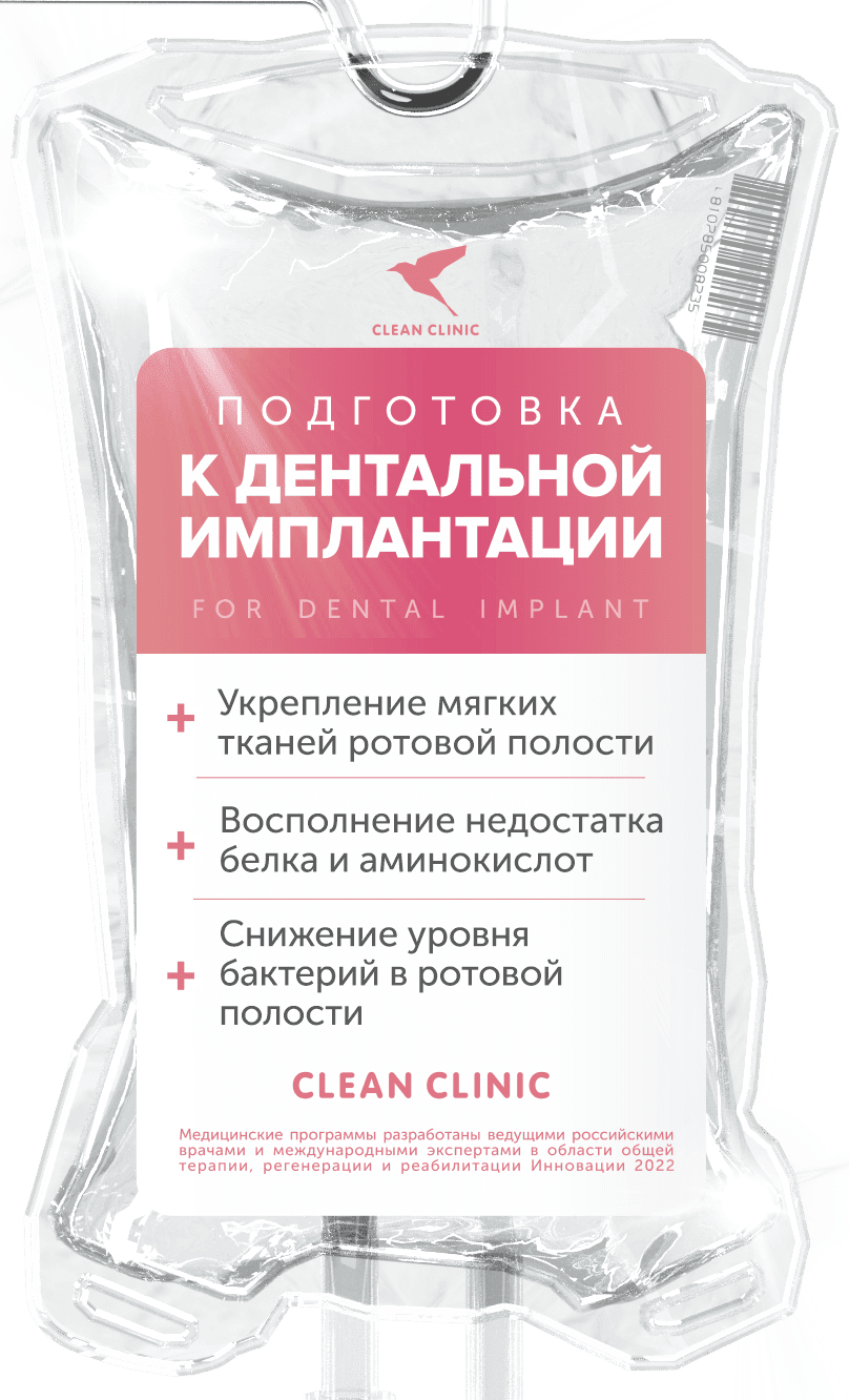 «Дентальная имплантация ДО»